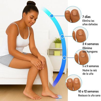 Dispositivo láser antimicótico para la eliminación de hongos en las uñas.